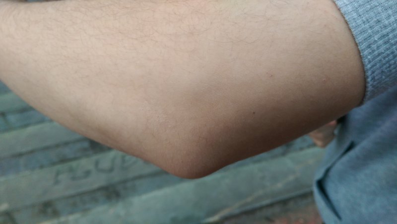 Ukalondo